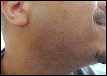 Whiskers Claw After You Shave