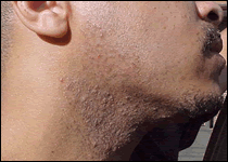 Whiskers Claw Before You Shave