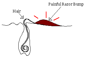 Whiskers Claw Step 1
